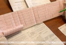 У кого может инфаркт миокарда проходить бессимптомно